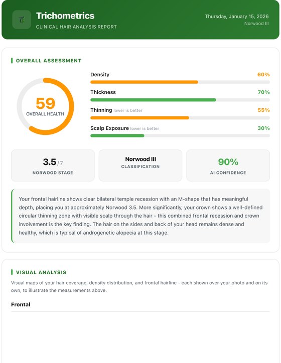 Clinical report - overall assessment and metrics