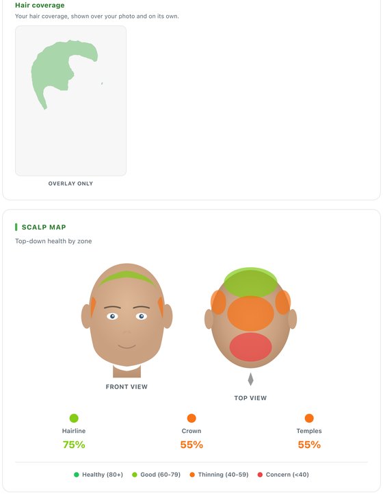 Clinical report - scalp map by zone