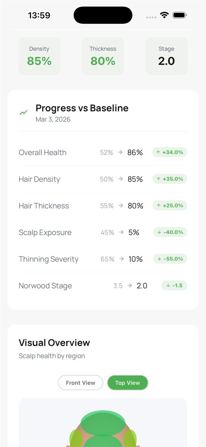 Progress vs baseline
