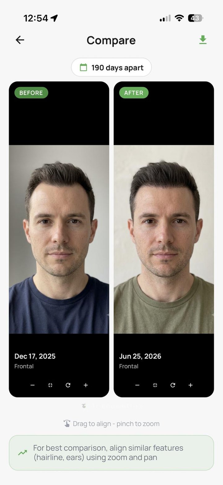 Before and after, perfectly aligned