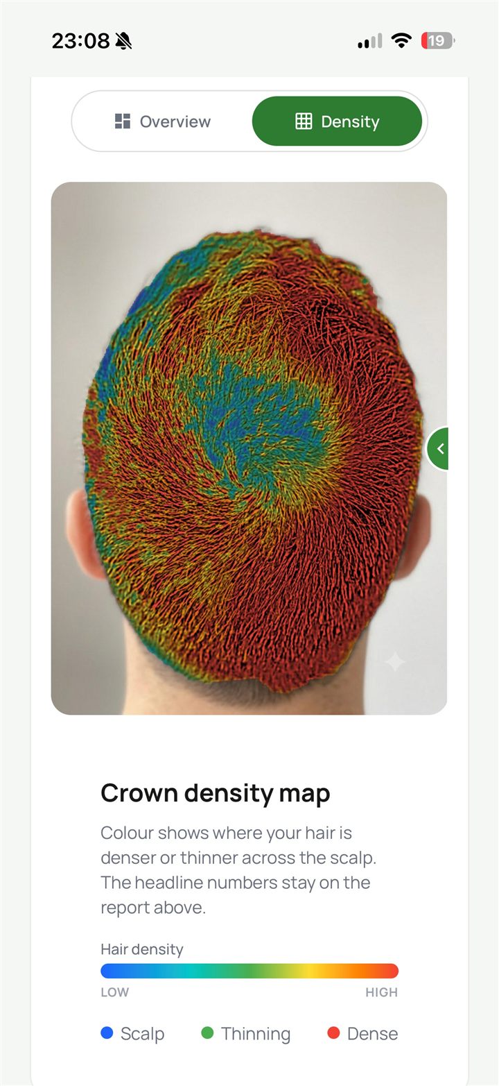 Crown mapping