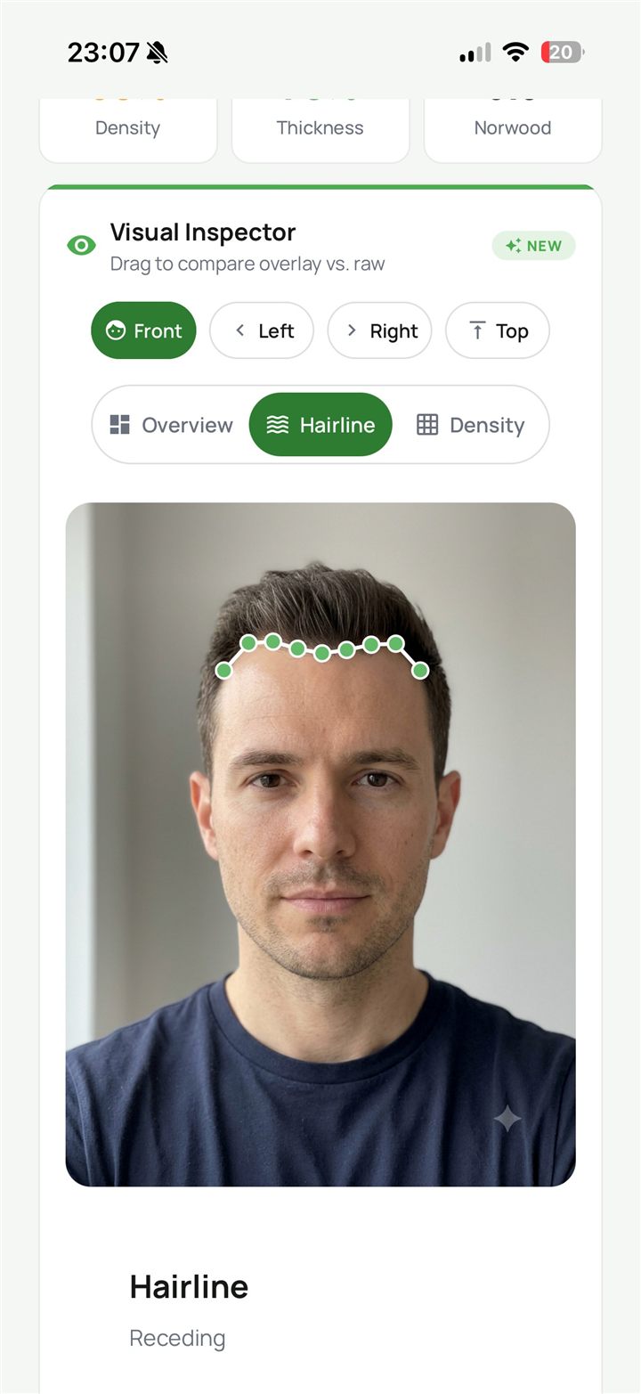 Track your hairline precisely