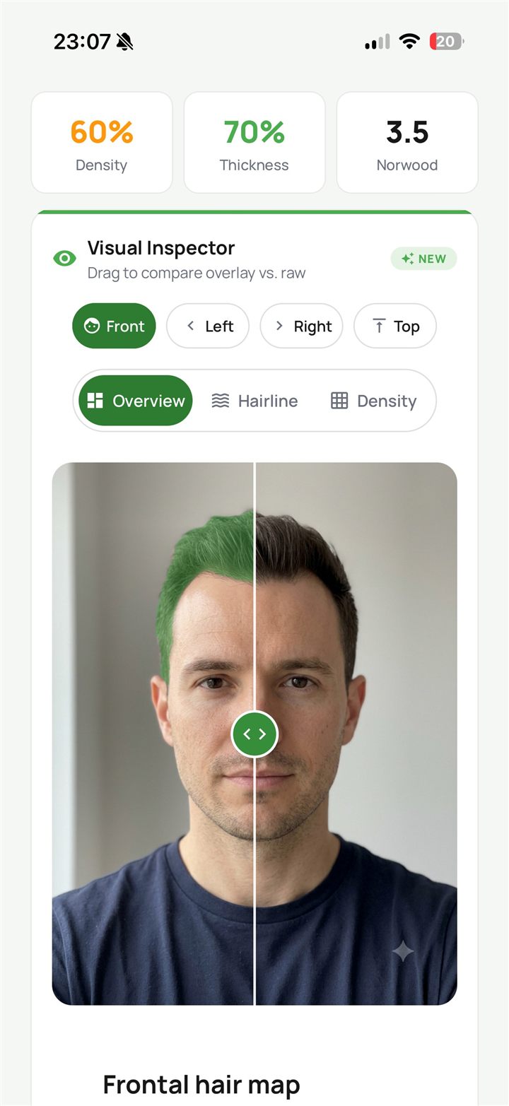 Compare the AI overlay to your real photo