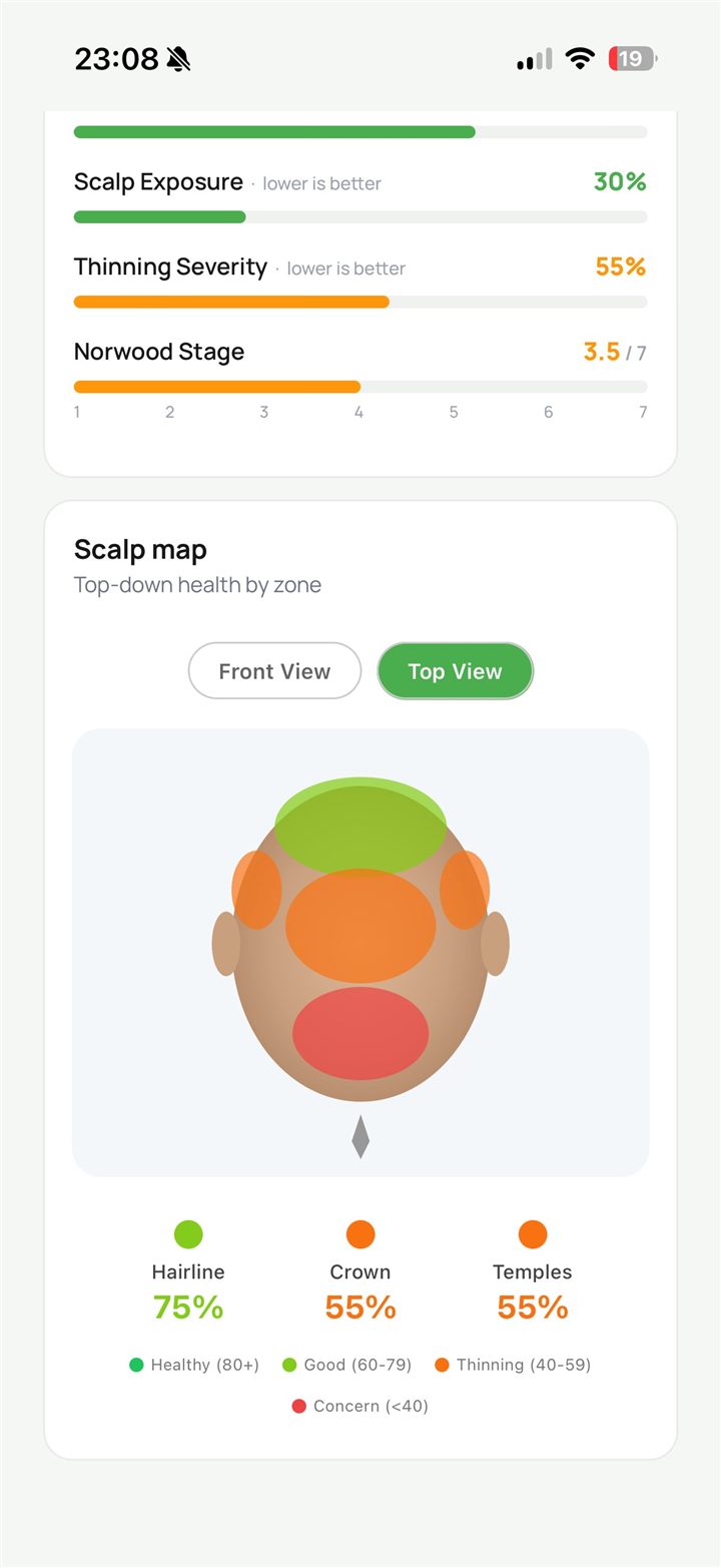 A health score for every zone